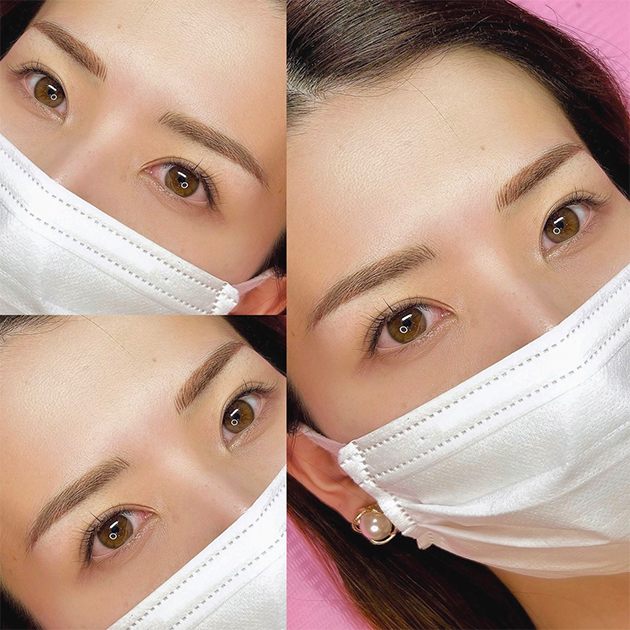 アイブロー症例
